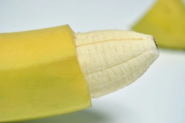 Восстановление после лечения фимоза: ограничения после операции