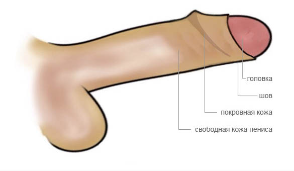 частичное обрезание при фимозе