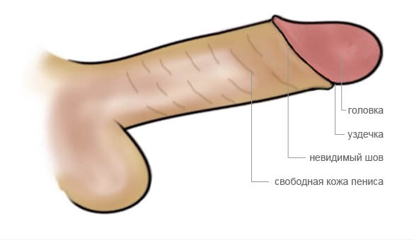 Cхема обрезания: пенис после обычного обрезания крайней плоти